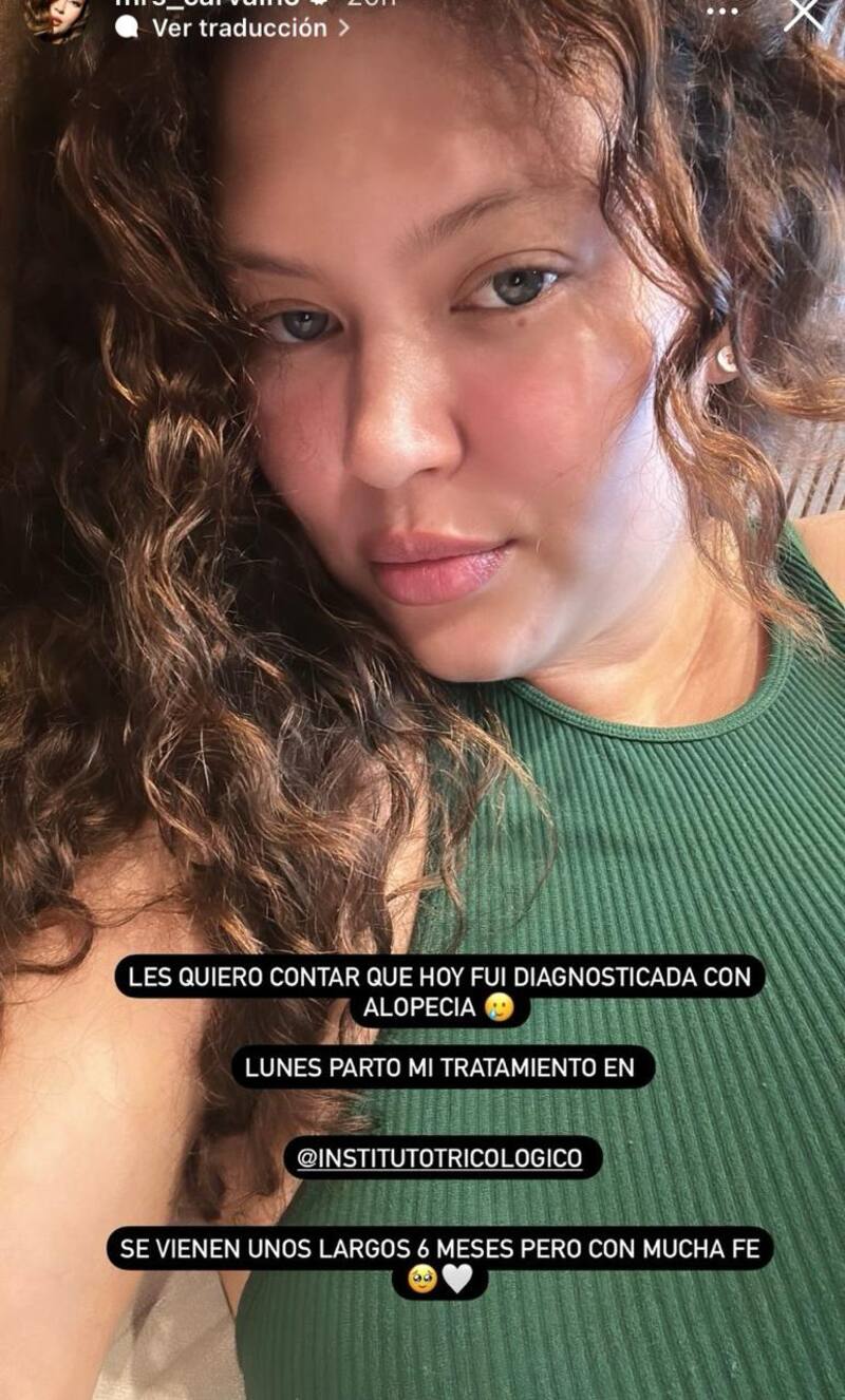 Michelle Carvalho reveló que sufre una delicada condición.