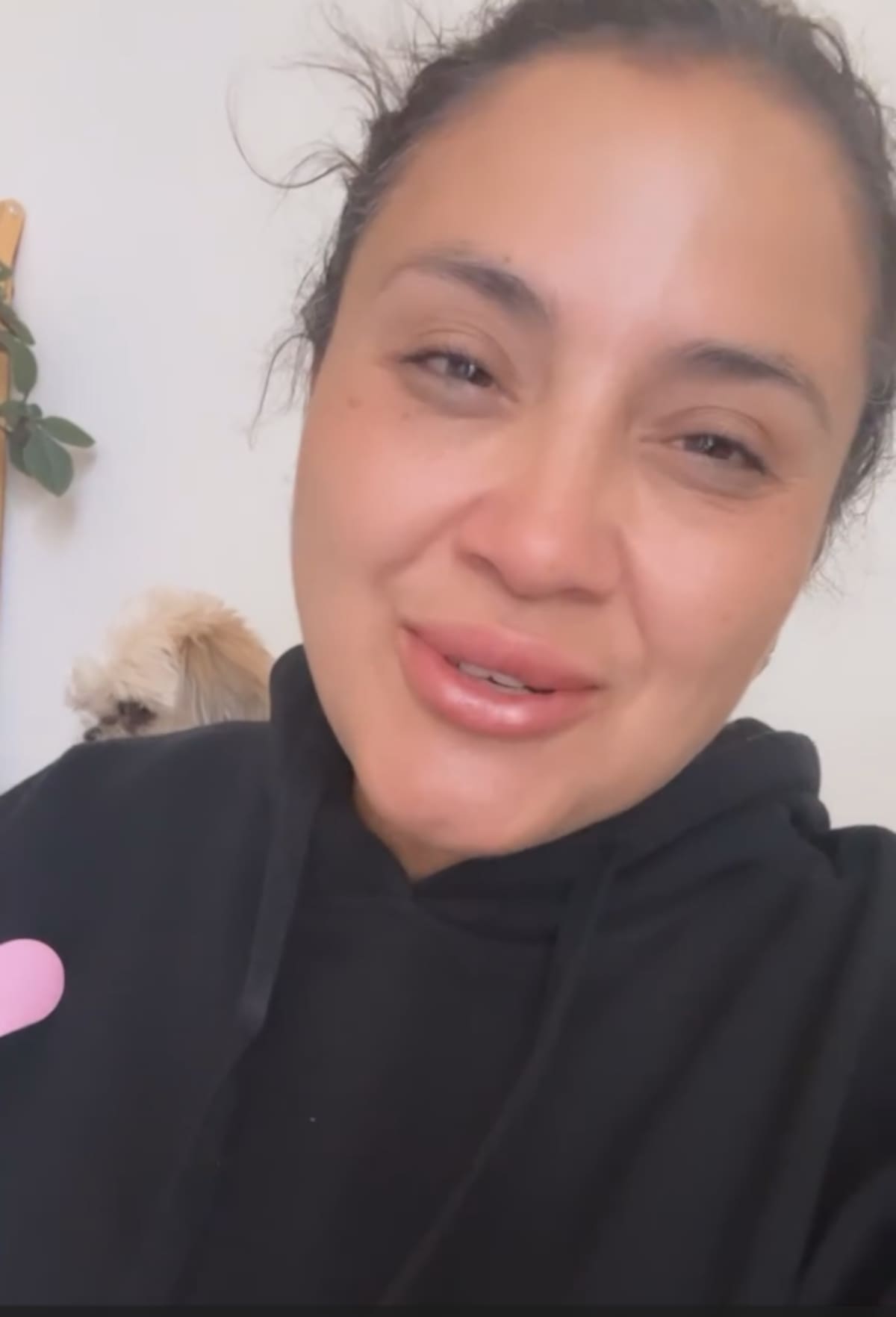 Pamela Leiva dijo que su madre mostró señales de mejoría tras sufrir un shock anafiláctico.
