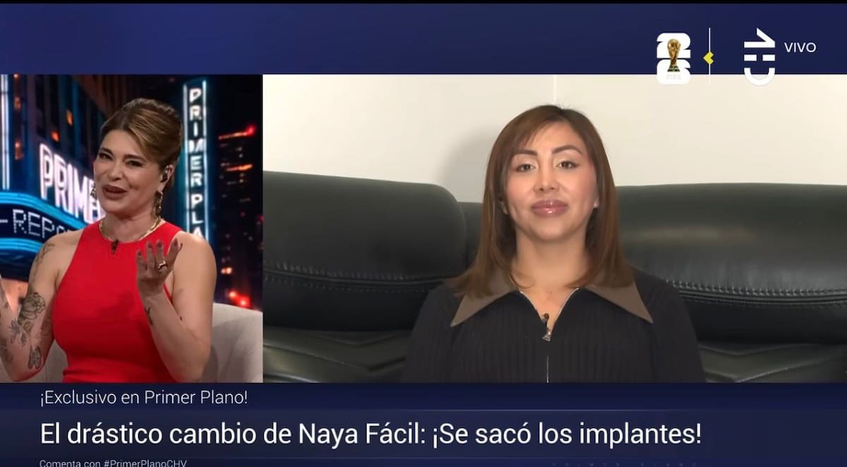Naya Fácil y su importante cambio físico.
Foto: captura @chv