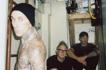 Travis Barker comparte fotos de su cirugía que impidió debut de Blink-182 en Sudamérica