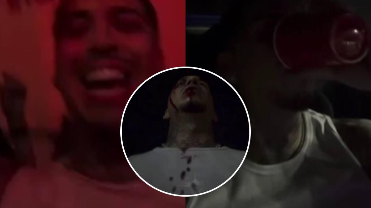 VIDEO | A un día de lanzar su nuevo álbum: Young Cister preocupa a sus fans tras subir impactante historia gravemente herido