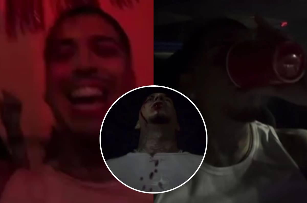 VIDEO | A un día de lanzar su nuevo álbum: Young Cister preocupa a sus fans tras subir impactante historia gravemente herido