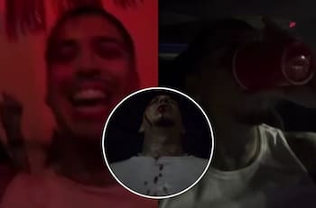 VIDEO | A un día de lanzar su nuevo álbum: Young Cister preocupa a sus fans tras subir impactante historia gravemente herido